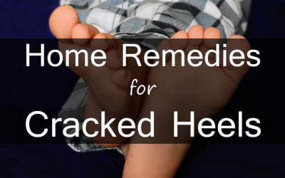 Summer Skin Care Tips